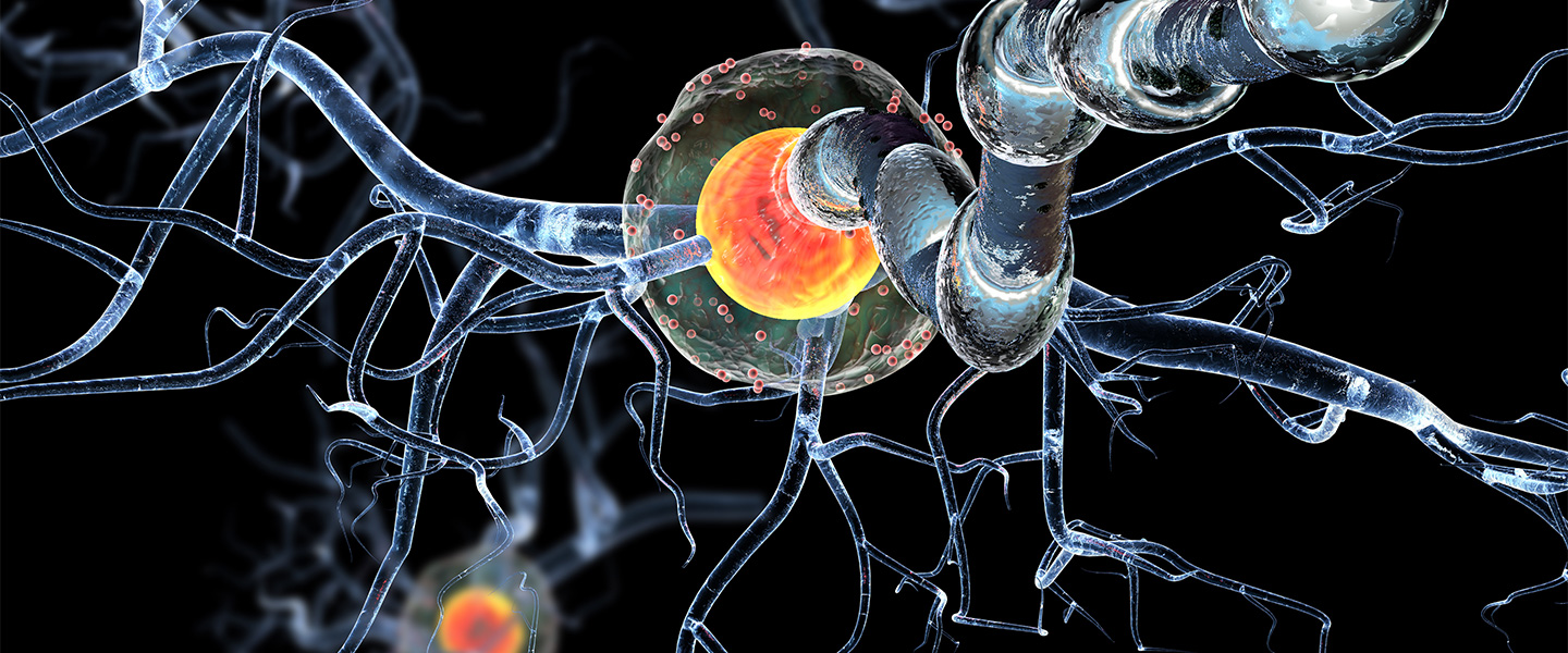 Multiple Sclerosis & Neuroimmunology The Ken & Ruth Davee Department of Neurology Feinberg
